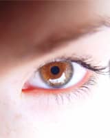 Eyelid Surgery | Blepharoplasty | Miami Beach FL | Miami Beach FL