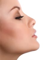 a close-up portrait of a woman's face, showing her nose after rhinoplasty