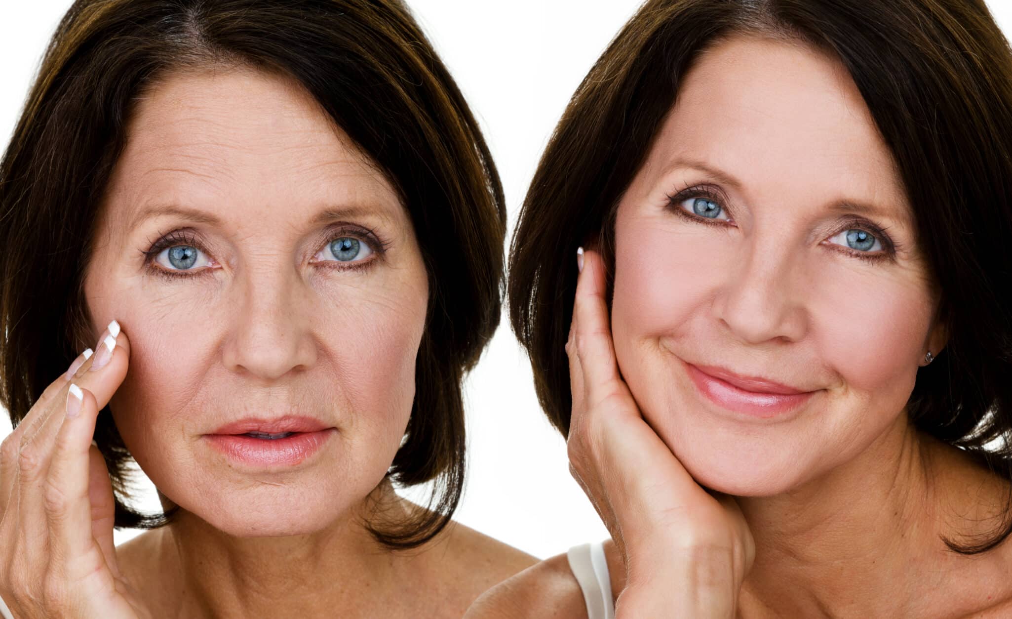 Skin care concept before and after facelift miami FL