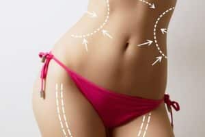 Lipo Treatment Areas