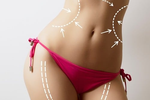 Lipo Treatment Areas