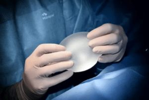 breast augmentation