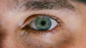 Blepharoplasty 300x169 Blepharoplasty 300x169
