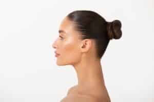 A profile shot of a woman after neck liposuction in Miami, FL