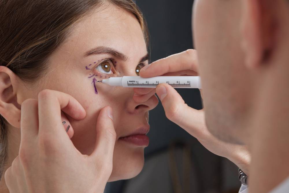 Blepharoplasty surgery Miami FL