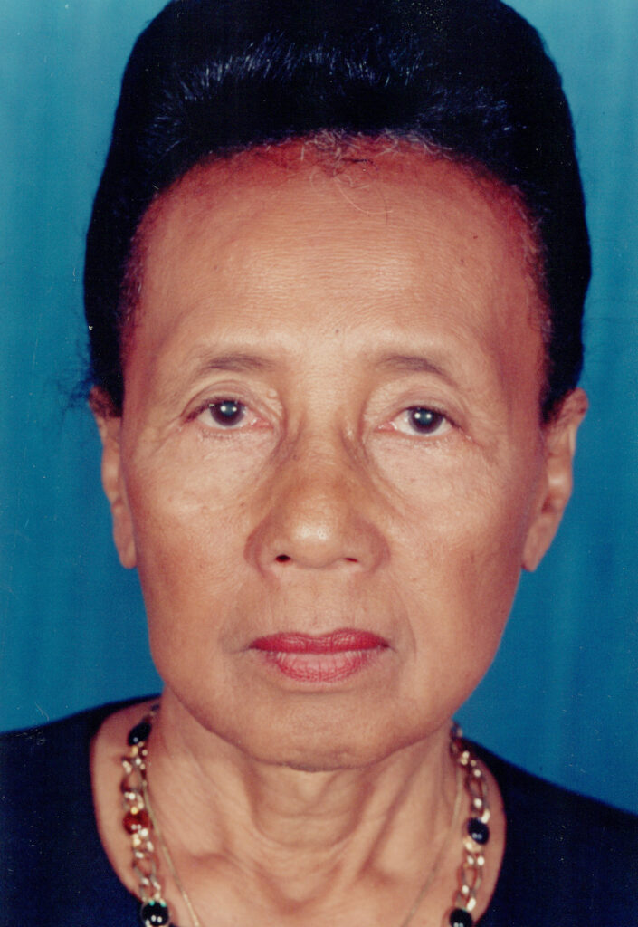 After Image: Face-Neck Lift - front