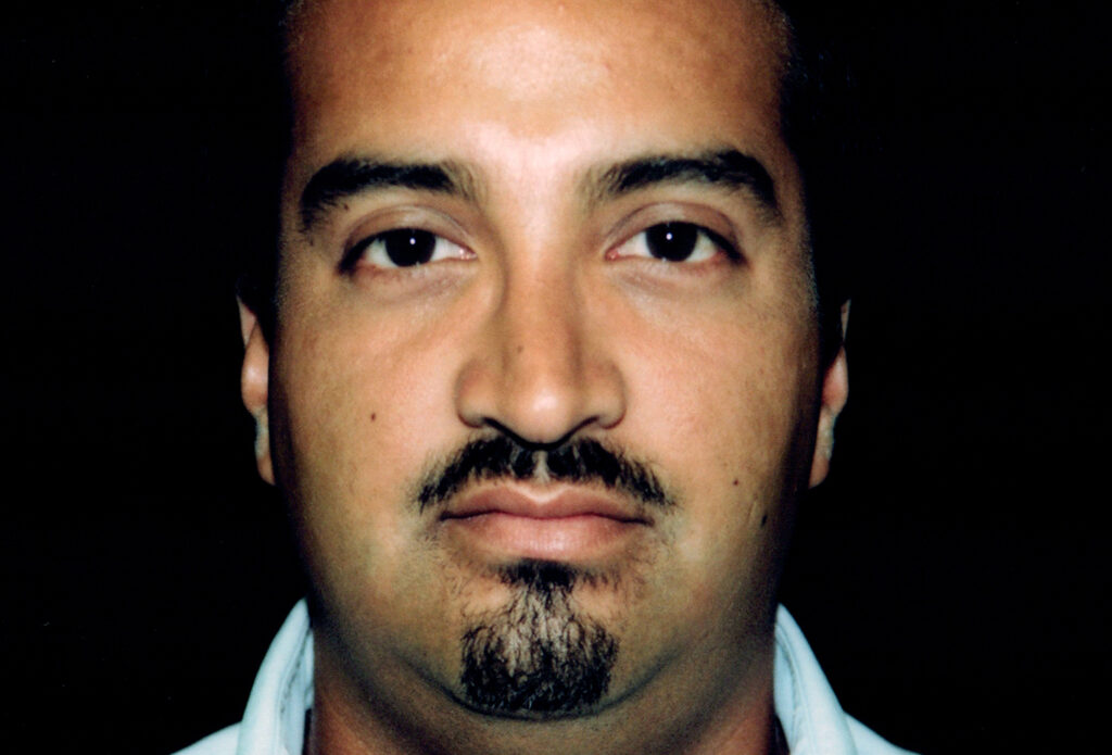 After Image: Rhinoplasty - front