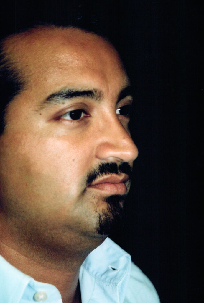 After Image: Rhinoplasty - right-front-oblique