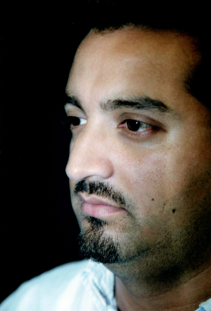 Before Image: Rhinoplasty - left-front-oblique