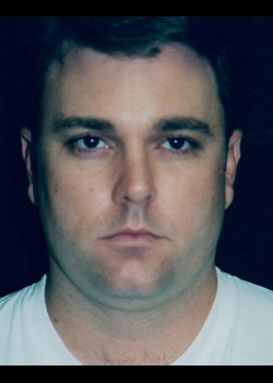 Before Image: Male Liposuction - front